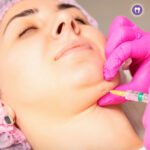 Double Chin Reduction