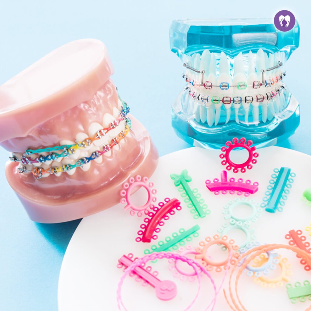 Orthodontic (Braces or Aligners) Treatment