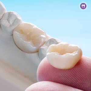 Zirconia Crowns